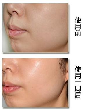 补水保湿最有效的项目,补水才是护肤的根本