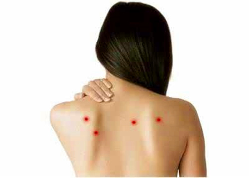 前胸后背长痘痘是什么原因引起的,前胸后背脖子长痘痘是什么原因呢