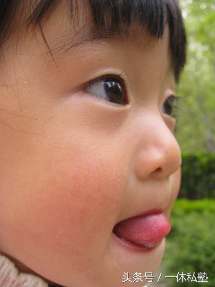 现在的孩子为什么都容易有黑眼圈,黑眼圈警告晚睡的小朋友