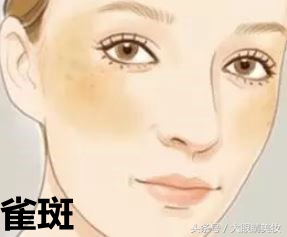 雀斑晒斑淡斑测评,雀斑晒斑淡斑又美白效果好到爆