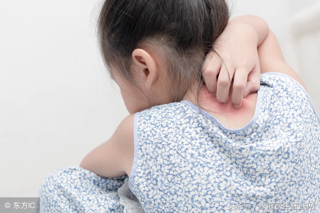 湿疹反复发作只因做错了这一点,孩子得湿疹反反复复怎么办