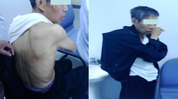 季节性神经痛小妙招,谷雨关节疼