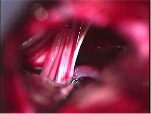 季节性神经痛小妙招,谷雨关节疼