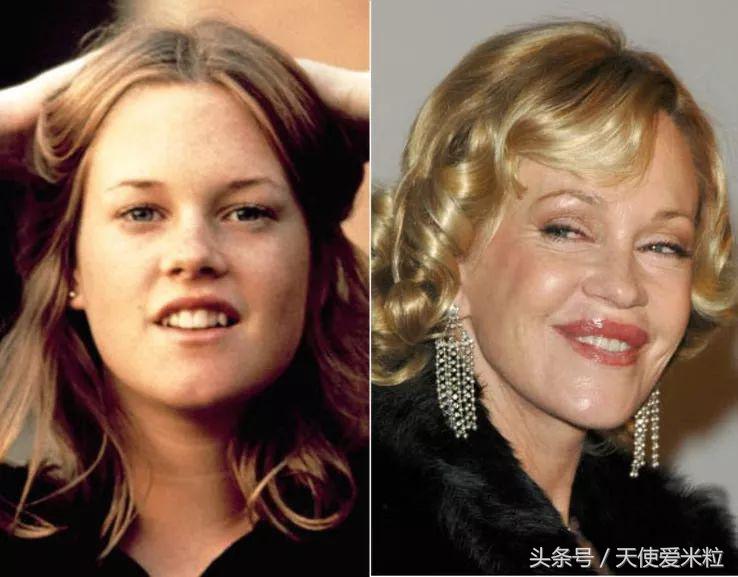 最新的整形塑形手术,7种整形手术可以尝试