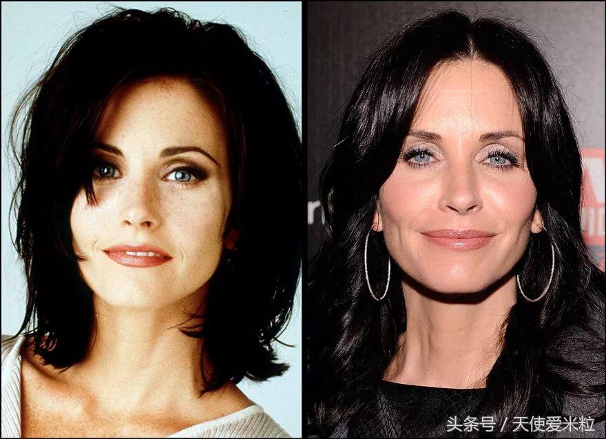 最新的整形塑形手术,7种整形手术可以尝试