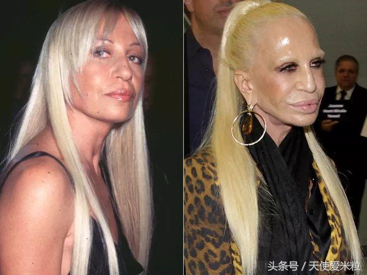 最新的整形塑形手术,7种整形手术可以尝试