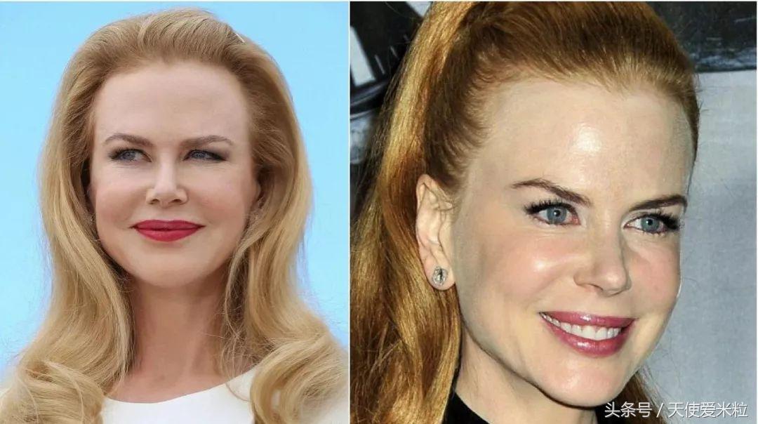 最新的整形塑形手术,7种整形手术可以尝试