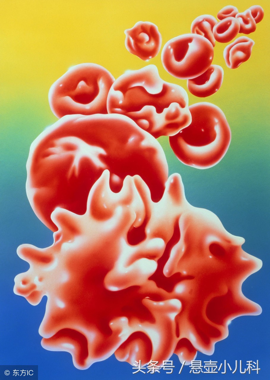 宝宝蚕豆病怎么查,宝宝有蚕豆病怎么检查出来