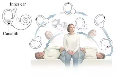 晨起头晕恶心天旋地转是什么原因,总是头晕天旋地转怎么回事