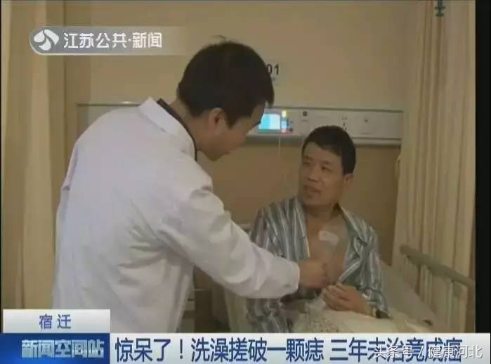 身体这3种痣别乱抠当心引发癌变,痣用手抠掉后有红褐色印记