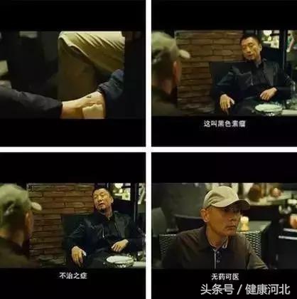 身体这3种痣别乱抠当心引发癌变,痣用手抠掉后有红褐色印记