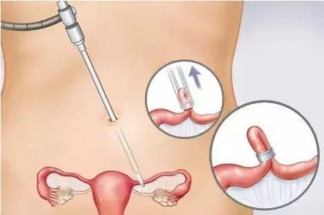 如何给孩子选择正确的运动方式,那些你不知道的运动项目