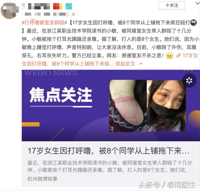 17岁女孩因打呼噜被舍友群殴，打鼾的我究竟应该怎么办？