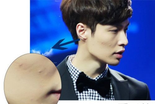 男神养成,男生变白祛痘指南