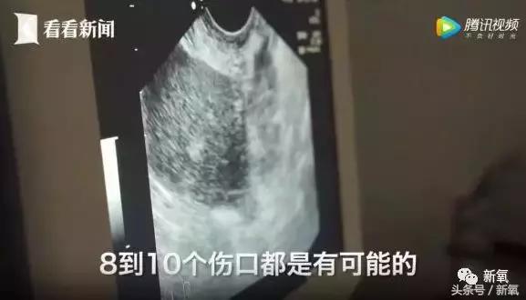 骗女生上床还买卖女生卵子,这些卖卵中介去死吧!