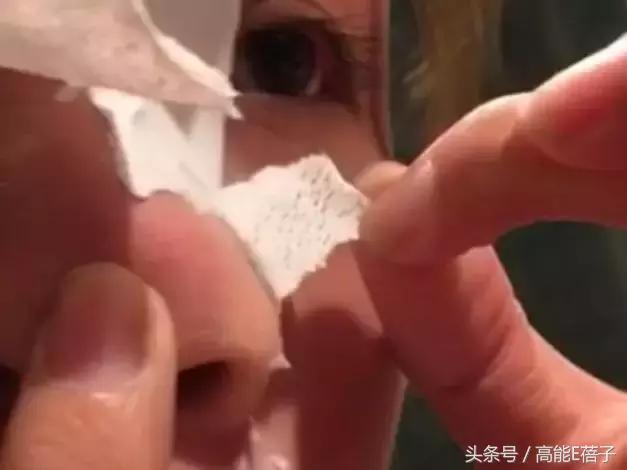 蔡徐坤、Angelababy都根治不掉的黑头，微商神器能去除？