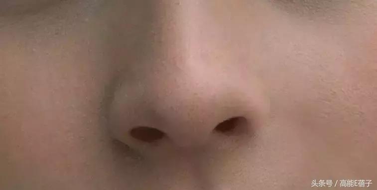 蔡徐坤、Angelababy都根治不掉的黑头，微商神器能去除？