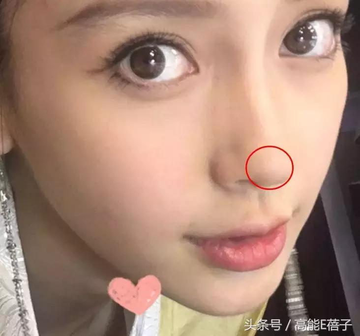 蔡徐坤、Angelababy都根治不掉的黑头，微商神器能去除？