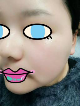 敷再多面膜就感觉脸干怎么办呢,敷完面膜脸上好多精华怎么办