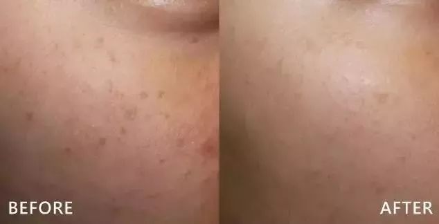 医美血泪教训,医美换脸一夜变美