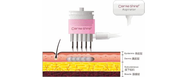 医美血泪教训,医美换脸一夜变美
