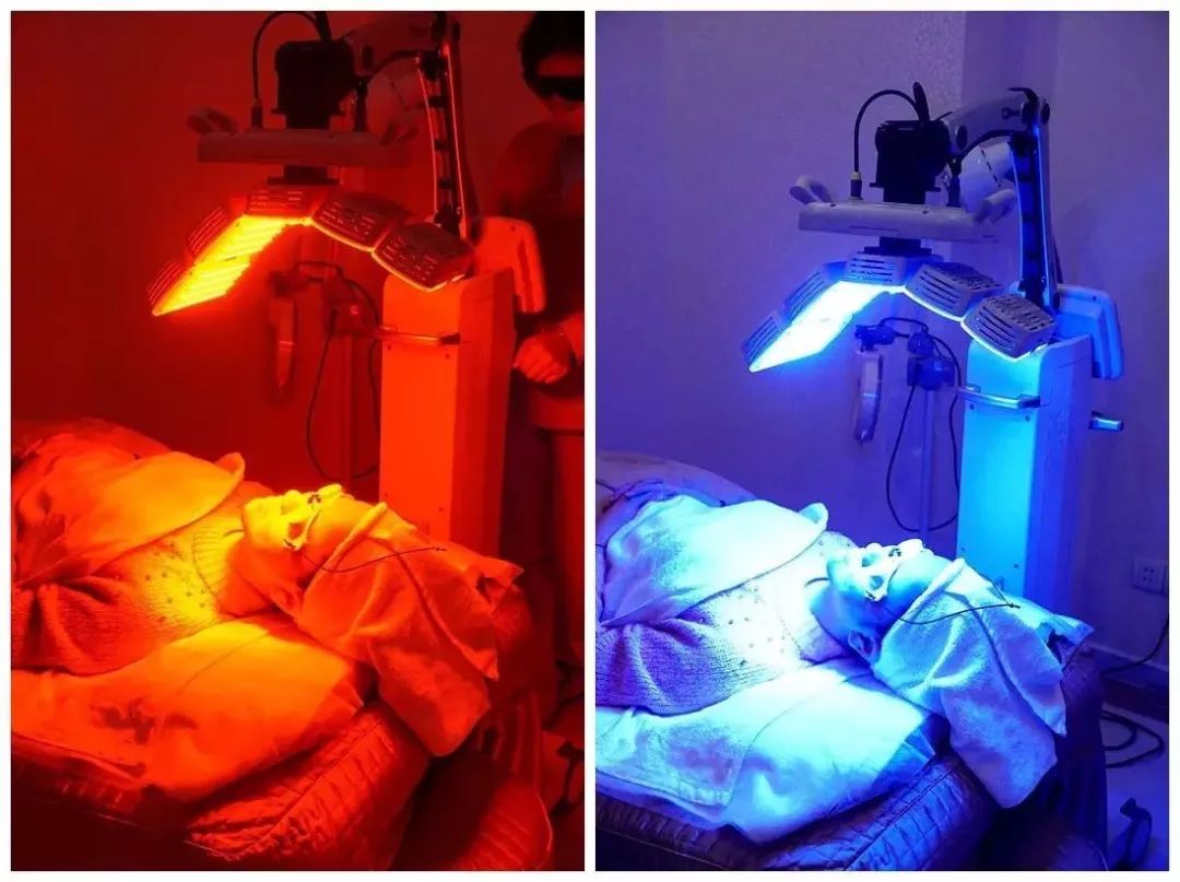 医美血泪教训,医美换脸一夜变美