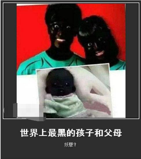 世界上最黑的黑孩子,世界上最黑的小孩长大后的样子
