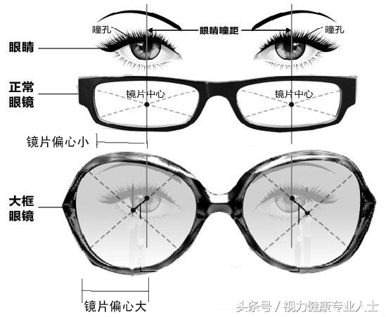 大脸显瘦近视眼镜,圆脸显瘦近视眼镜