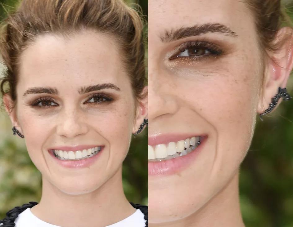 艾玛沃森的颜值变化,艾玛沃森素颜雀斑脸