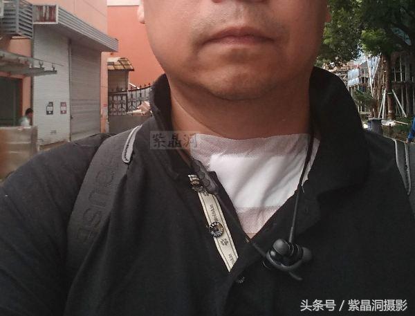 甲状腺结节手术需要住院几天出院,甲状腺结节做消融手术多少天出院