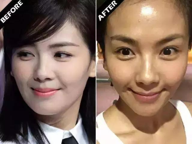 身上肤色不均匀黑一块白一块,面部肤色不均匀暗黄怎样调理