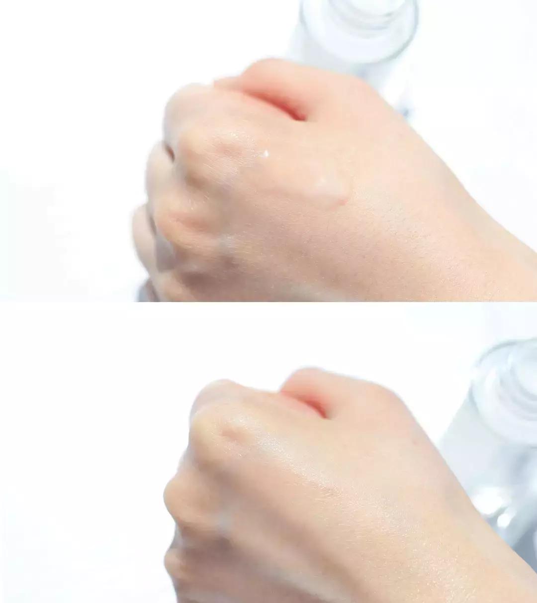 身上肤色不均匀黑一块白一块,面部肤色不均匀暗黄怎样调理