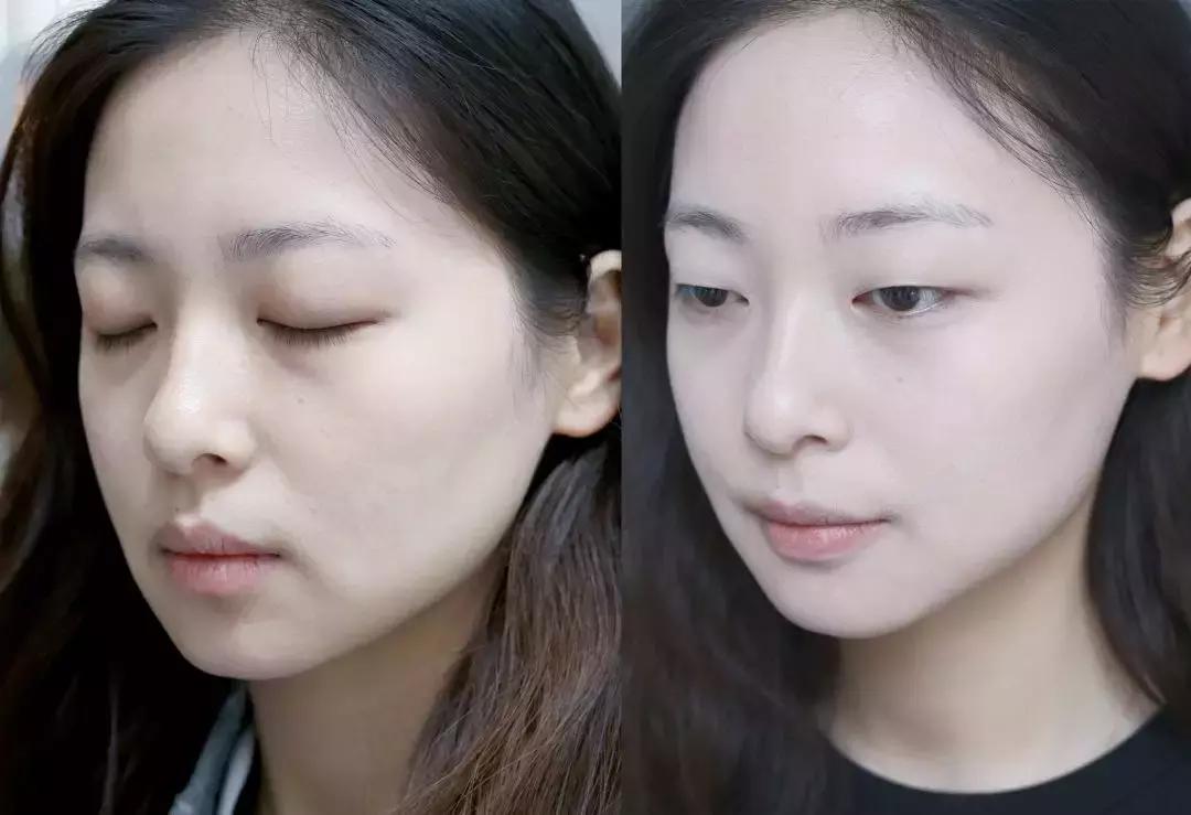 身上肤色不均匀黑一块白一块,面部肤色不均匀暗黄怎样调理