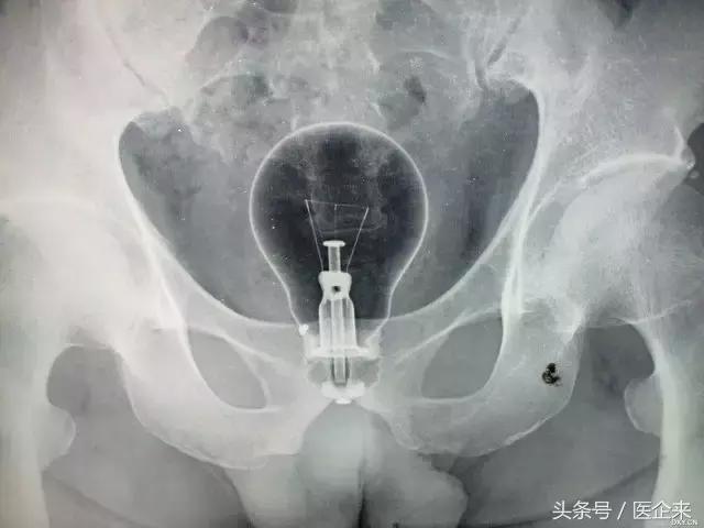 不可思议奇怪的东西,不可思议小物件穿透