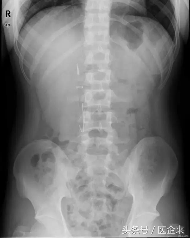 不可思议奇怪的东西,不可思议小物件穿透