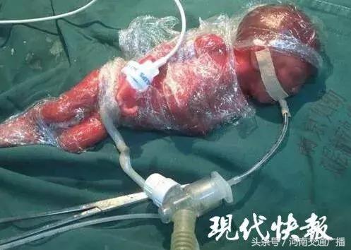 怀孕八个月早产胎儿大概有几斤,孕妇五个月22天重11斤正常吗