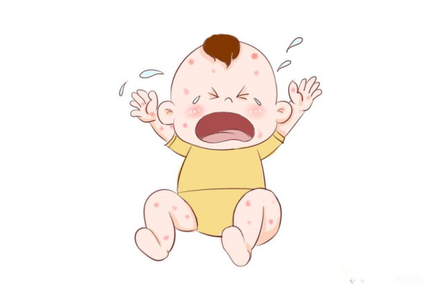 小儿湿疹家长最关心的问题,小孩有湿疹怎么办最快最有效