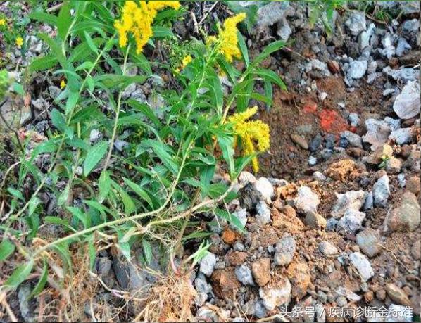 风热感冒扁桃体发炎吃什么中药,咽炎百日咳