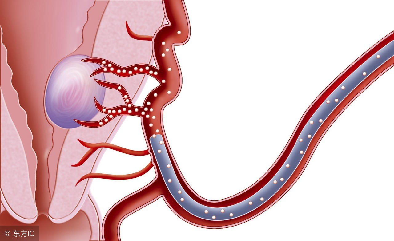哪里医院可以检查子宫内膜癌病理,tct检查和子宫内膜癌有关系吗