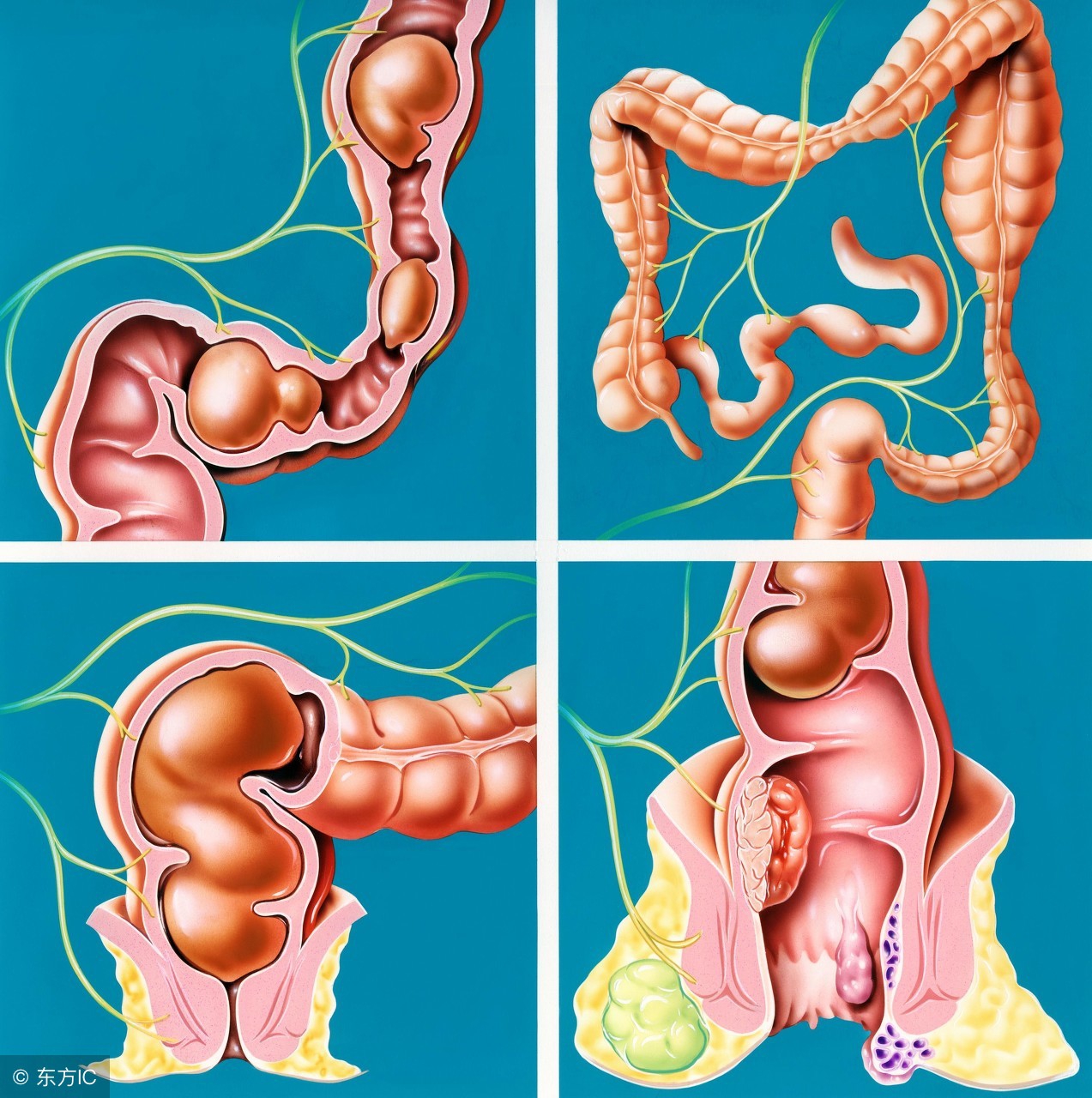 便秘！便秘！别拿便秘不当病！五种食物来预防！