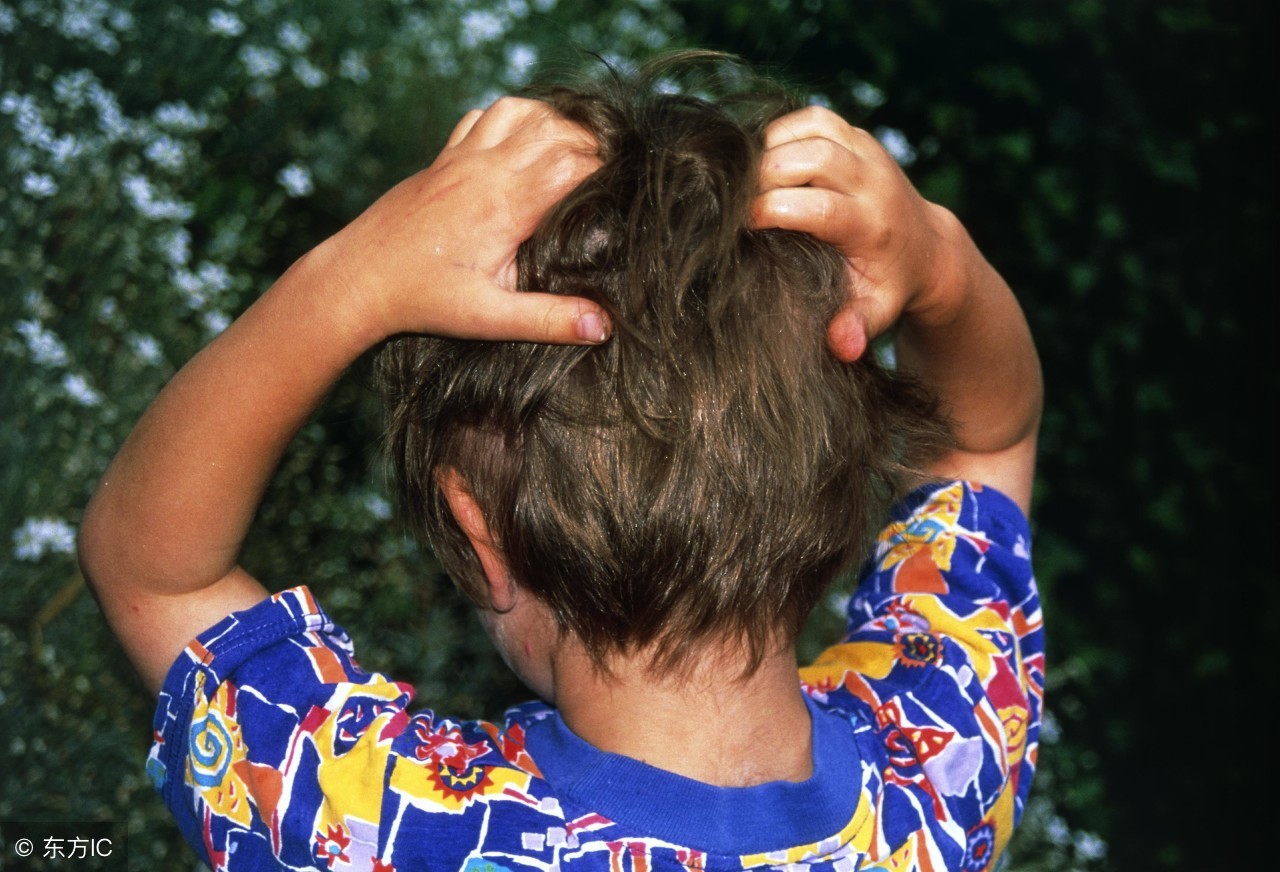 竟然有人身上会有虱子？