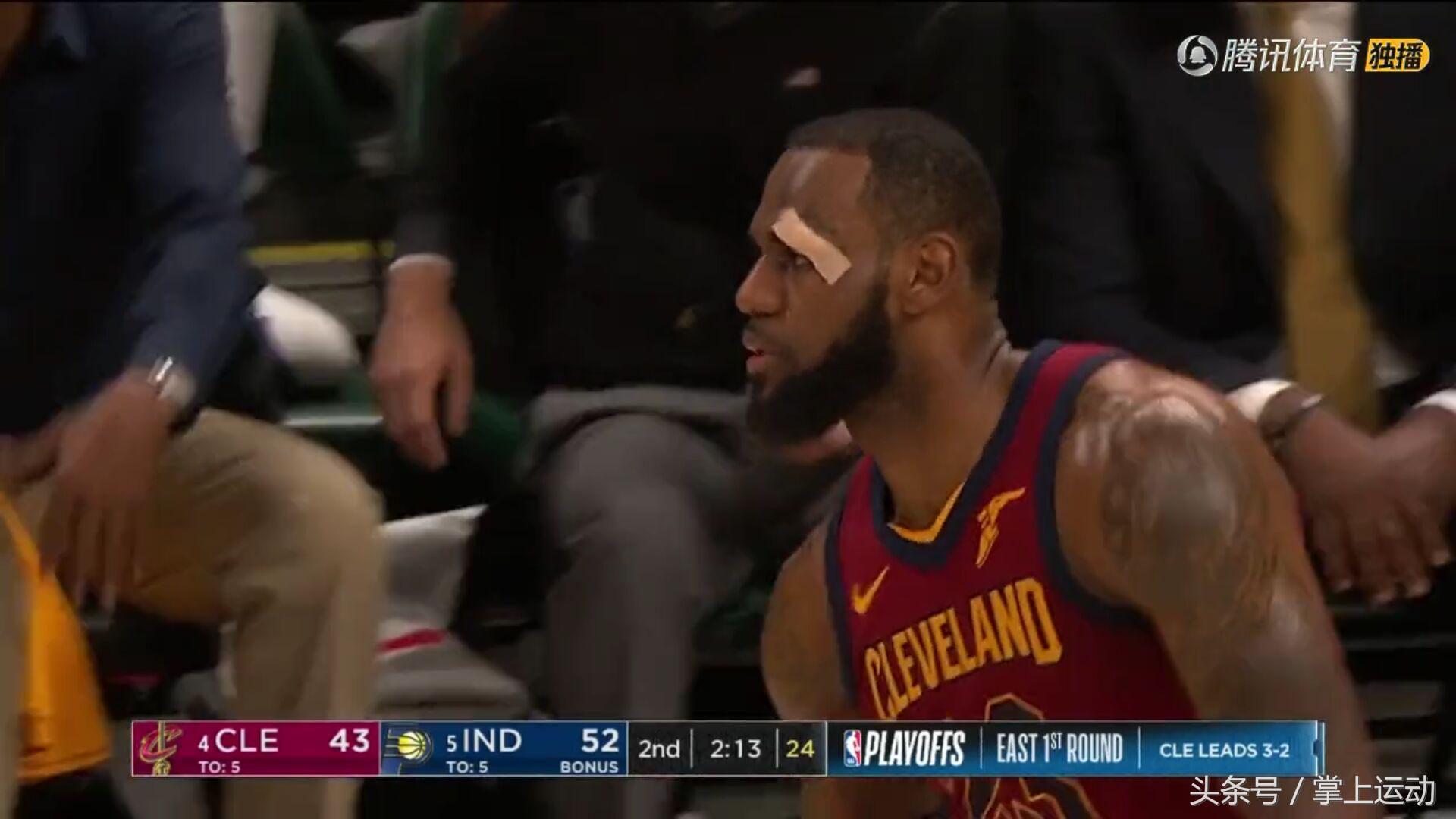 詹姆斯肘击对手致其出血遭驱逐,詹姆斯被肘到眼角出血