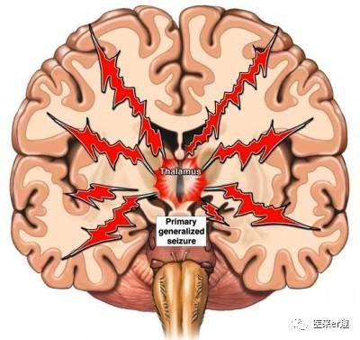 发热与热性惊厥，爸妈的盲点和难点详解，让您不做发热恐惧症父母