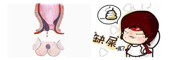 怎么可以避免怀孕得痔疮,怀孕女性的外痔疮怎么治疗