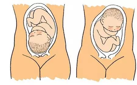 孕期如何补充叶酸,孕期如何补充叶酸及注意事项