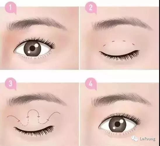 医美有哪些比较有用的,医美套路有多深爱美的你需警惕