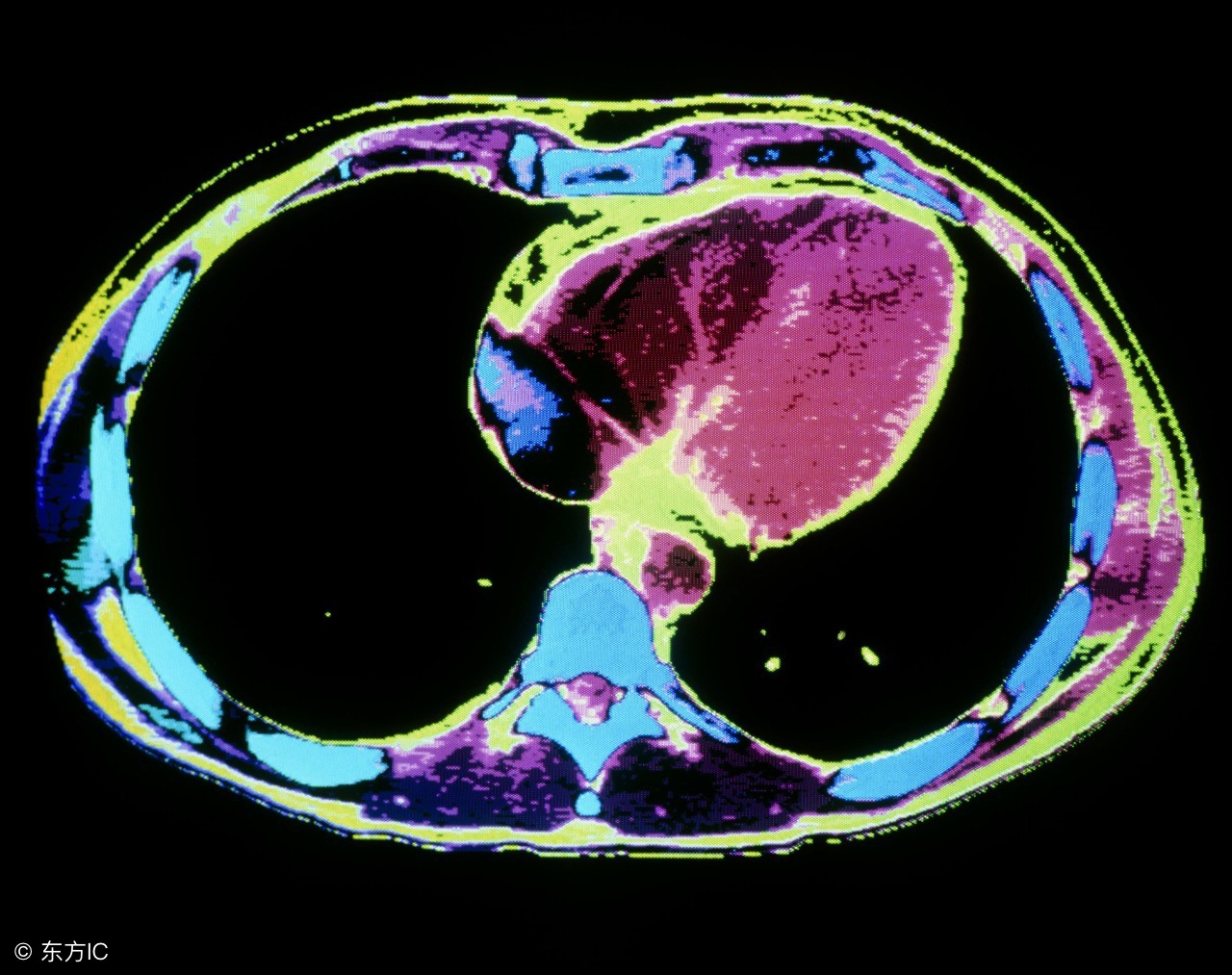 胃镜检查能判断食管癌吗,胃镜检查能查食管问题吗