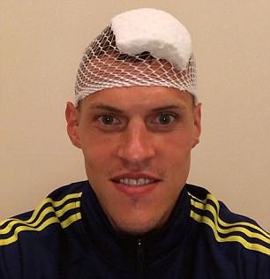 GOAL神奇：足坛第一硬汉是他？被“爆头”仍微笑后卫们学着点！