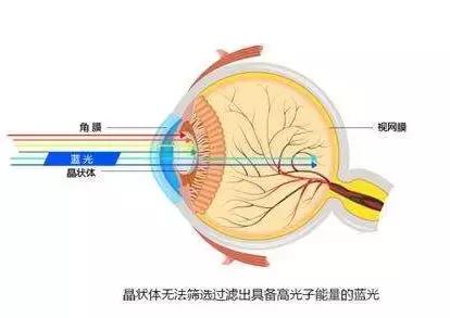 高端老花眼镜远近两用防蓝光,挺贵的防蓝光眼镜真的有用吗