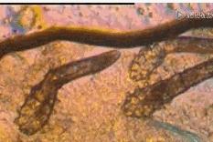 枕芯一年不洗有效果吗,1年没洗过的枕头放大